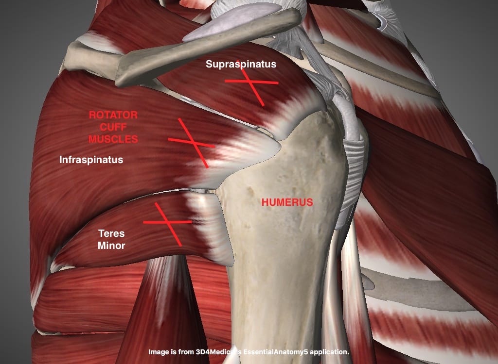 How Long Does Rotator Cuff Surgery Take : In some cases, surgery is ...