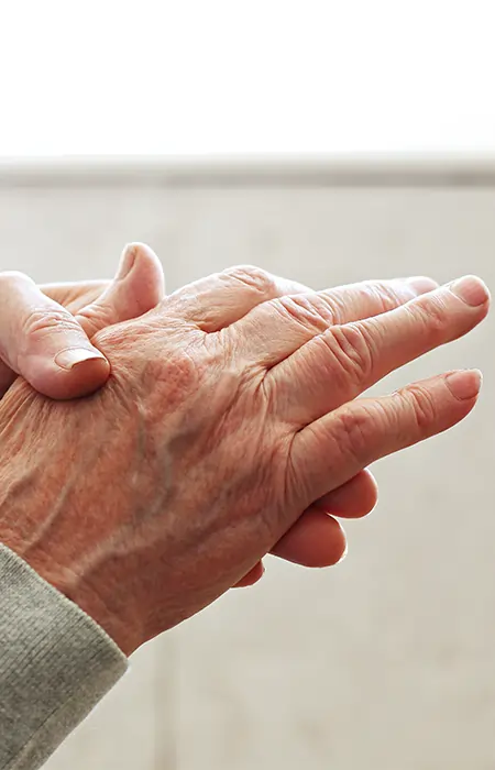 CHARM Osteoarthritis