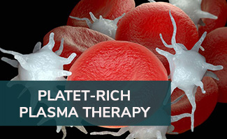 CHARM - Platelet-Rich Plasma Therapy