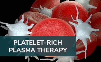 platelet-rich-plasma-therapy