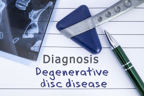 Diagnosis: Disc Disease